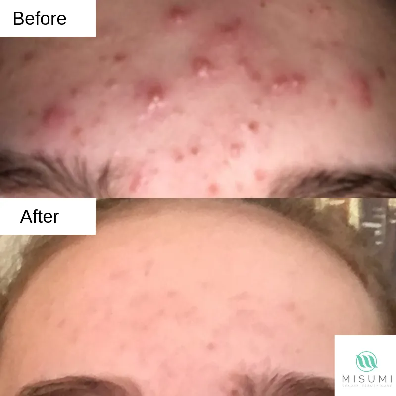 Clear Skin Duo Set