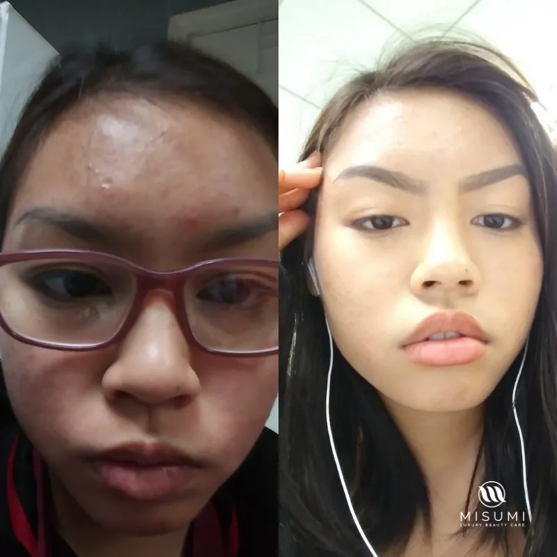 Clear Skin Duo Set