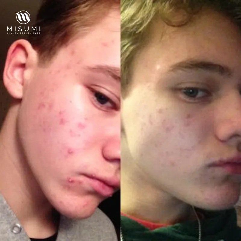Clear Skin Duo Set