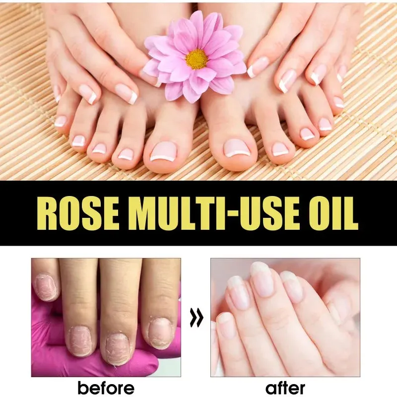 "Rose Petal Essential Oil Moisturizing Serum for Body, Skin, Hair, and Nails - Foot Care for Repairing Dry, Cracked, and Chapped Skin"